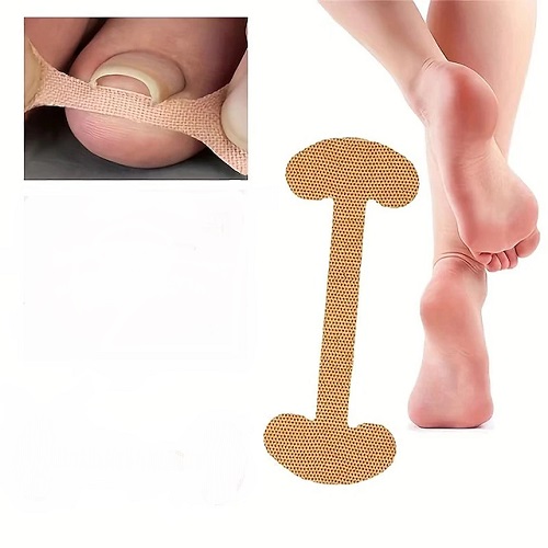 Ingrown Toenail Plasters